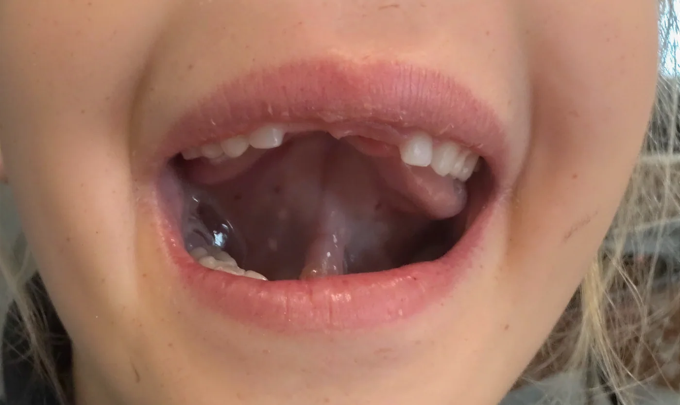 Paladar - después (expandido)
