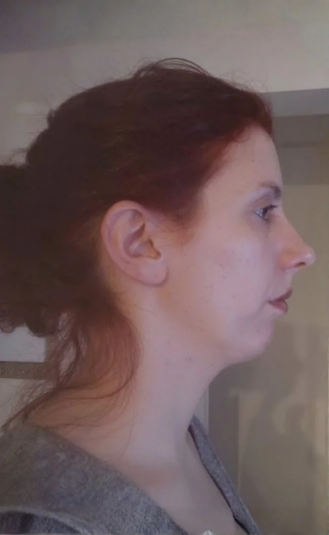Cristina - antes