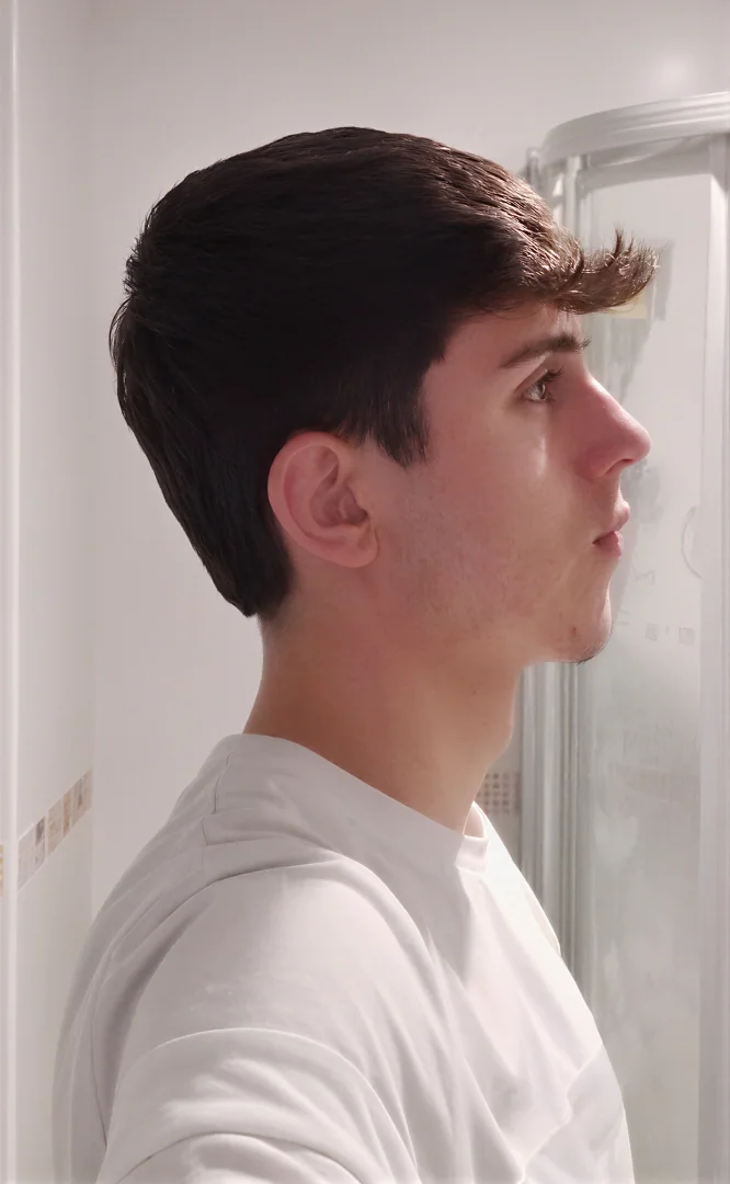 Ignacio - antes