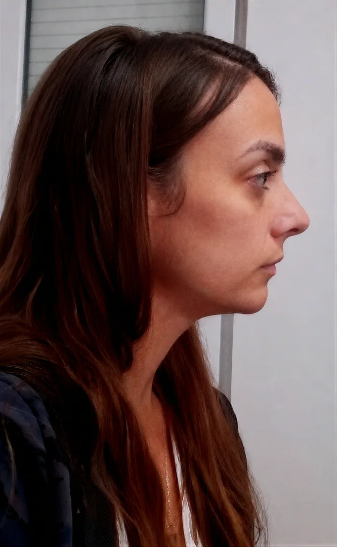 Lucía - antes