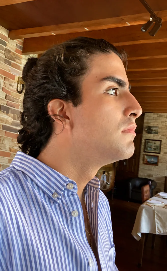 Miguel - antes